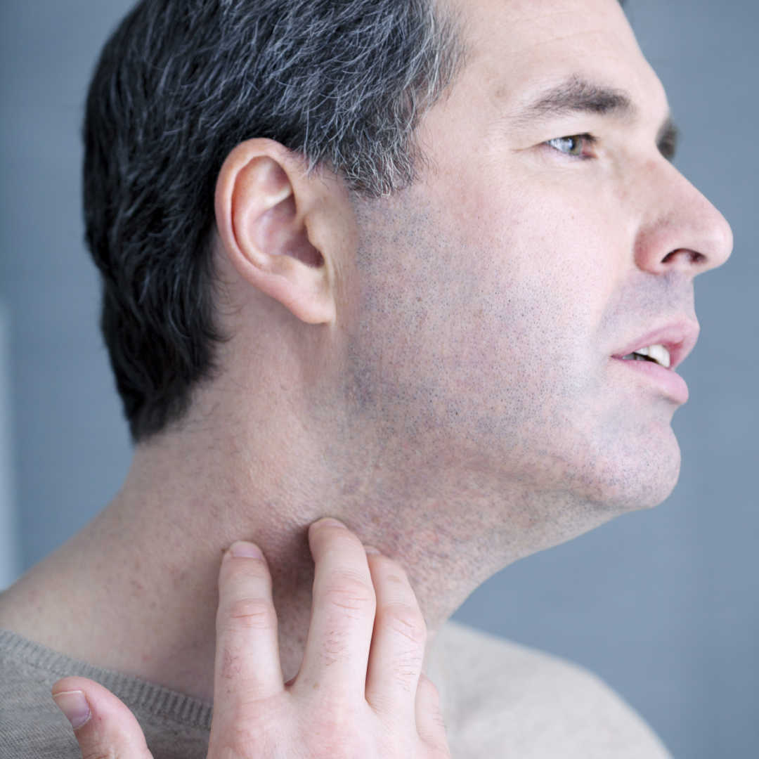 Shaving With Psoriasis Sharpologist