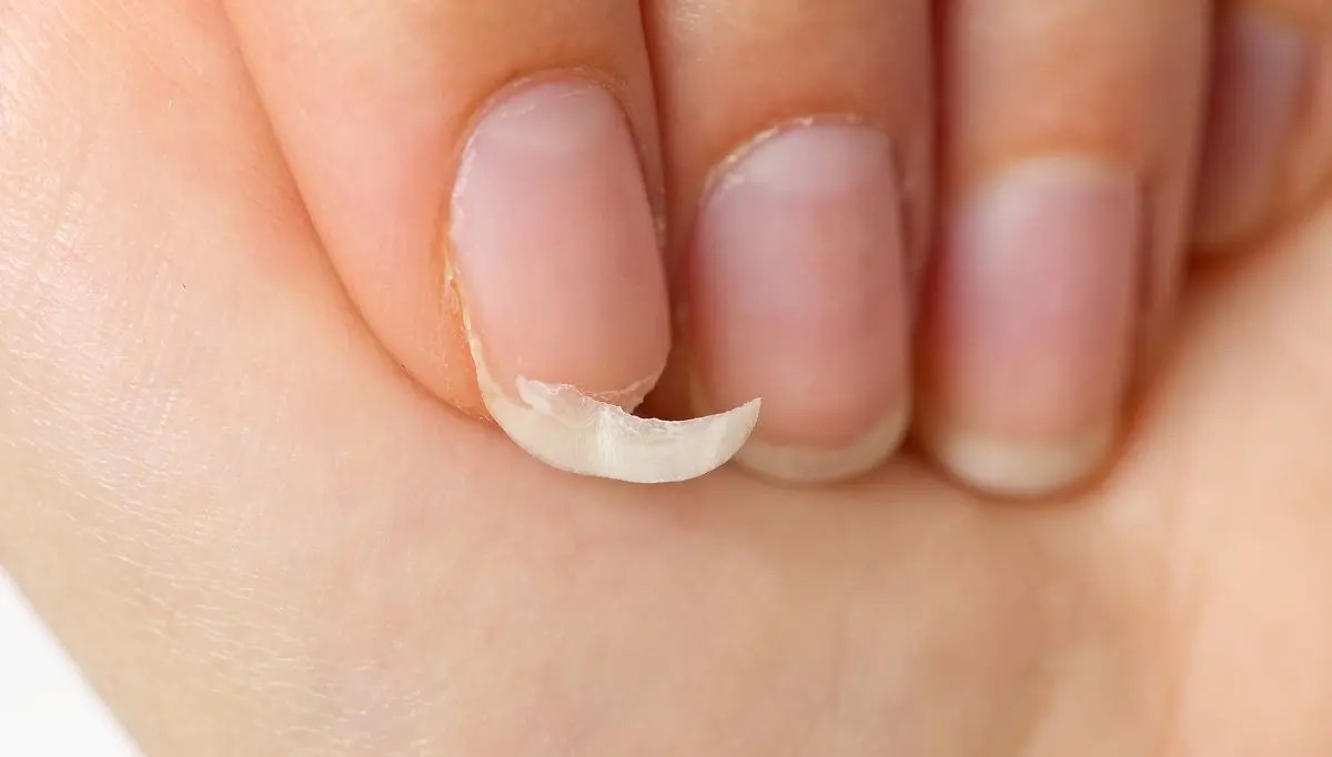 How To Fix Fingernails That Grow Upwards