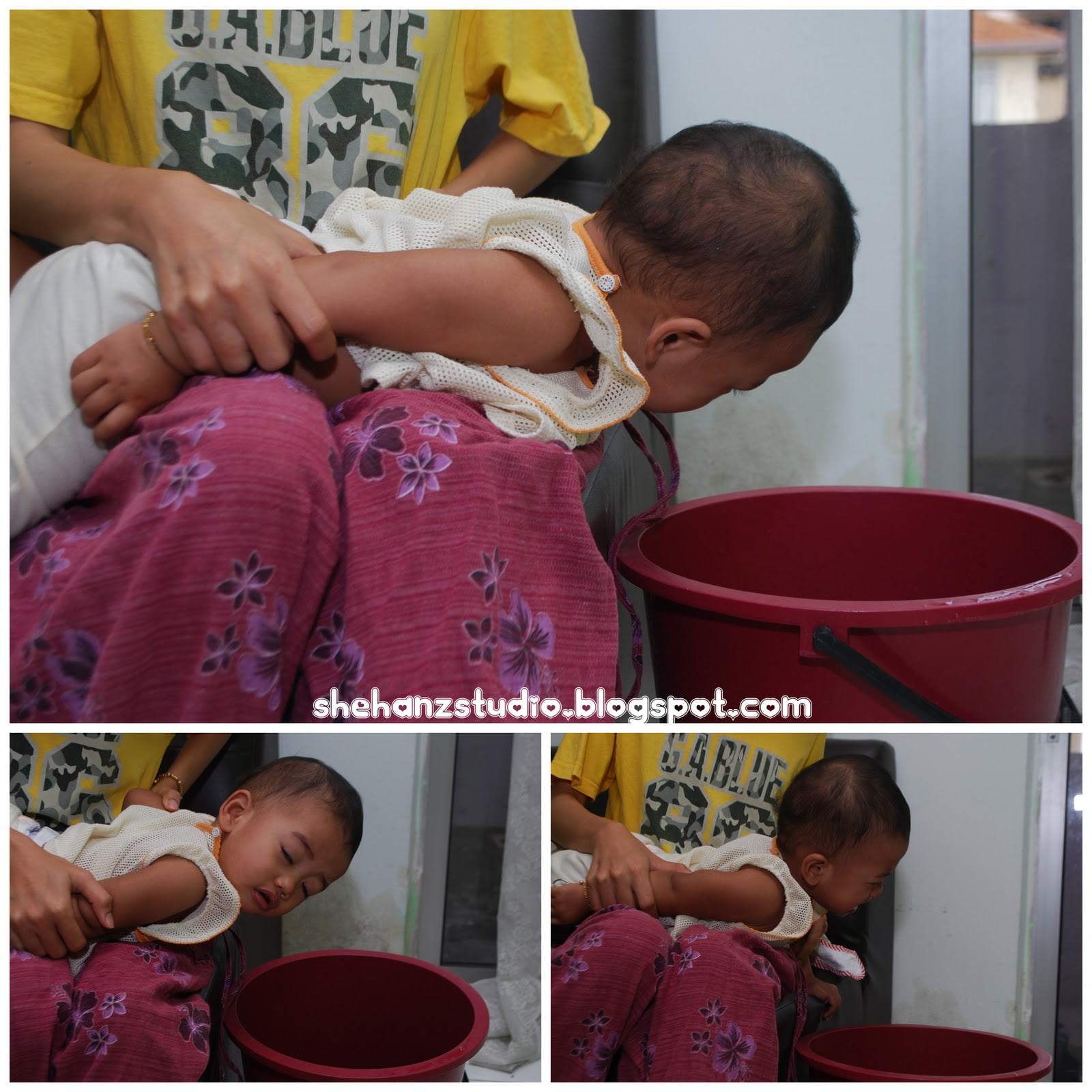 Jom Cuba Cara Steaming Dan Percussion Untuk Flu Batuk