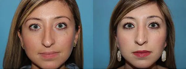 How Long Does Anesthesia Stay In Your System After Surgery furnitdesign