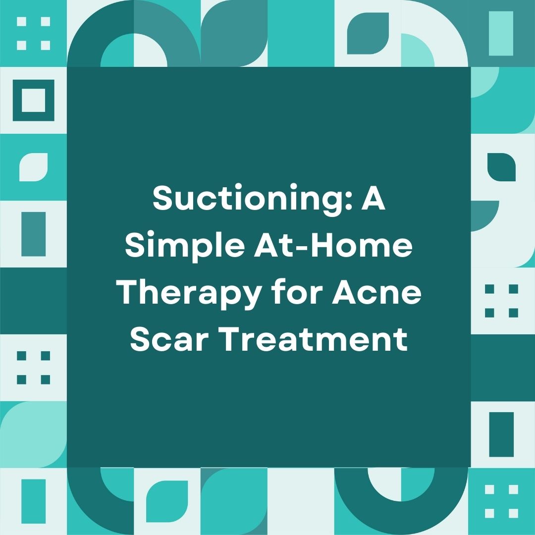 Suctioning A Simple AtHome Therapy for Acne Scar Treatment