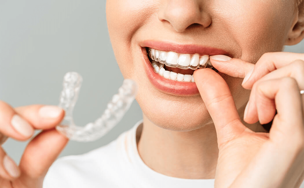 Best Orthodontist in Al Ain Orthodontist in Al Ain UAE