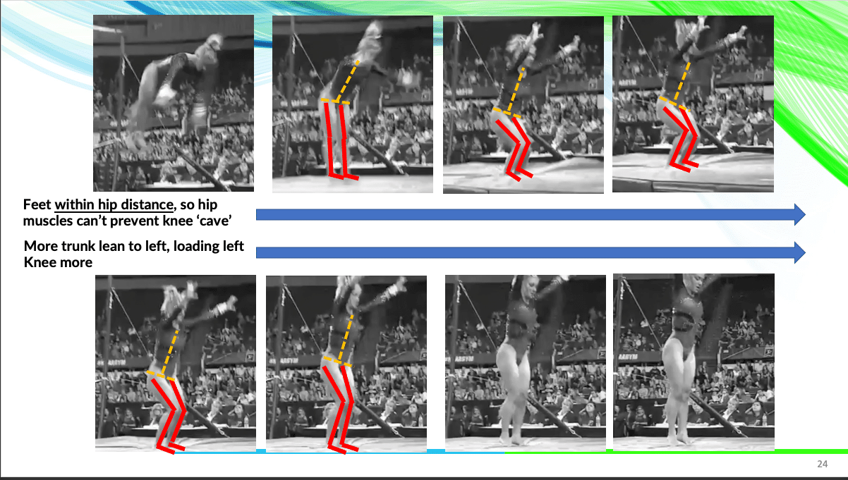 The Need to Change Landing Deductions in NCAA Gymnastics for Less Knee