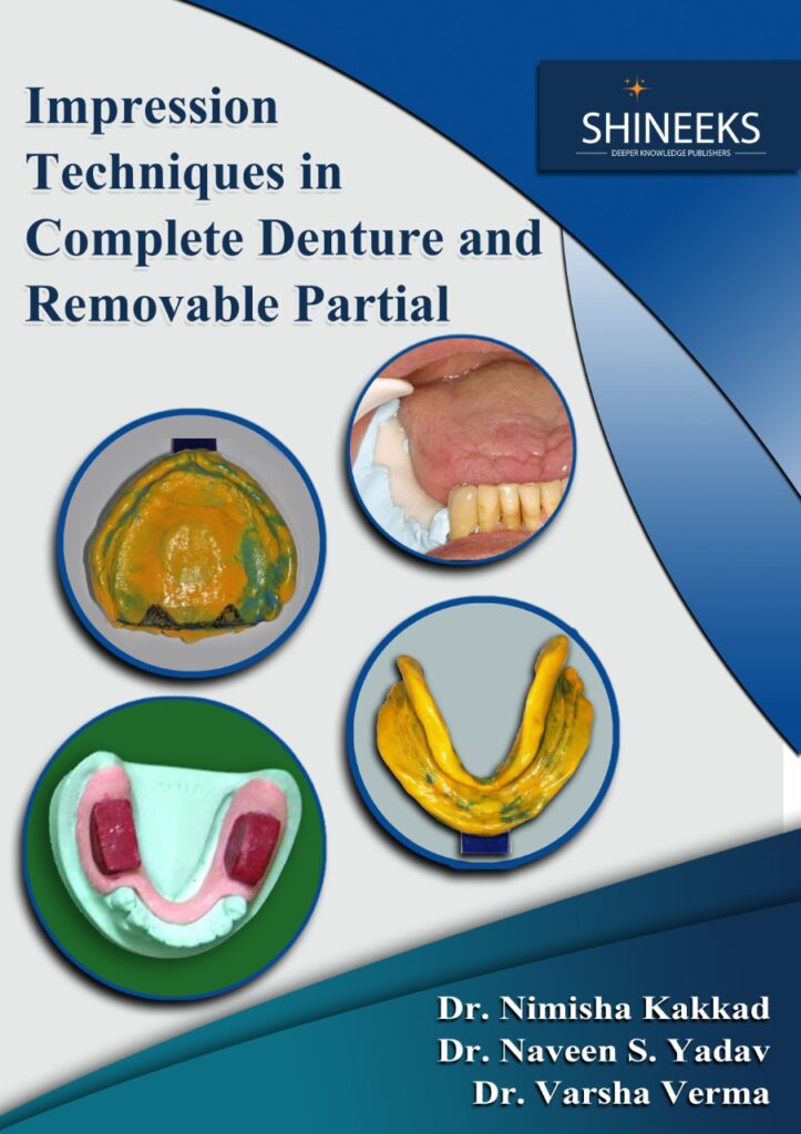 Impression Techniques in Complete Denture and Removable Partial Denture Shineeks
