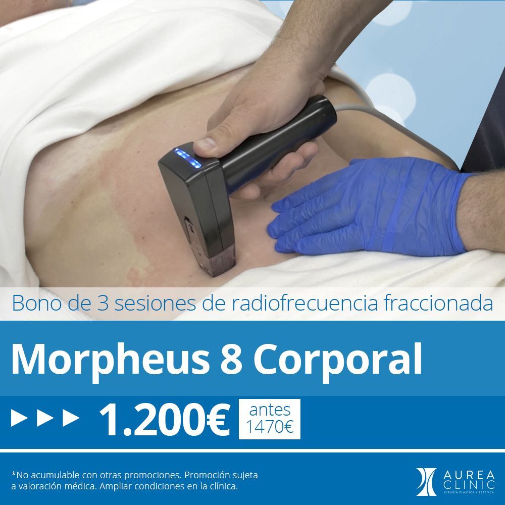 Bono de 3 sesiones de Morpheus 8 Corporal en Sevilla Aurea Clinic