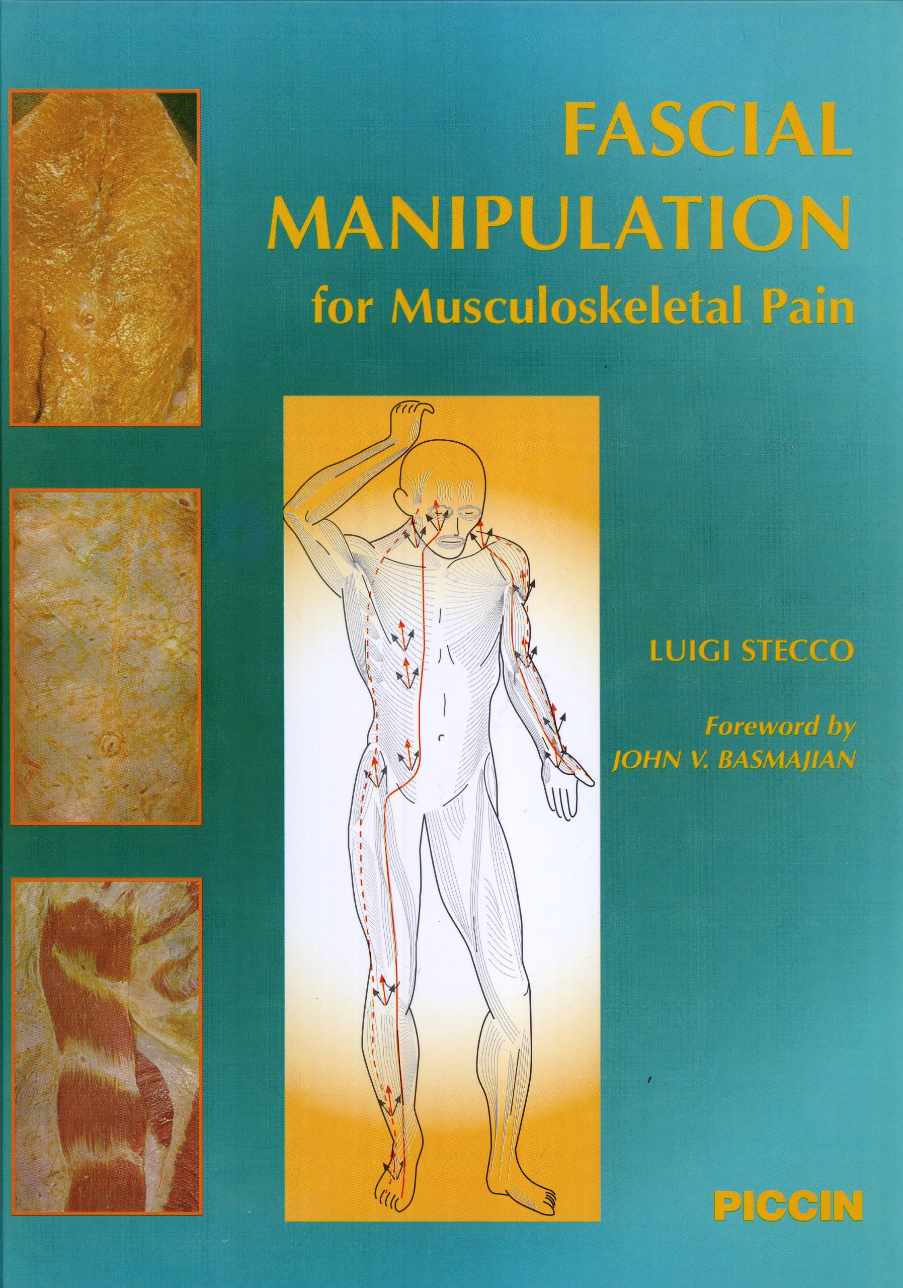 Fascial Manipulation for Musculoskeletal Pain