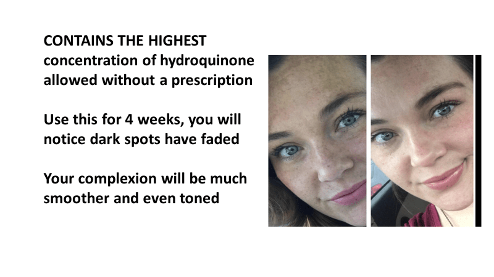 2 Hydroquinone Dark Spot & Melasma Corrector Admire my skin KU8AM