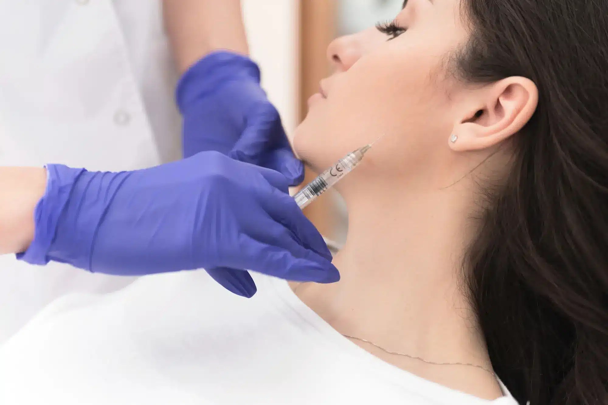 From Tension to Tranquility Treating Awake Bruxism with BOTOX®