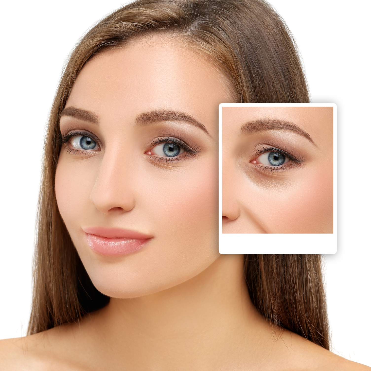 Eyelid Rejuvenation » Premier Dermatology & Aesthetics