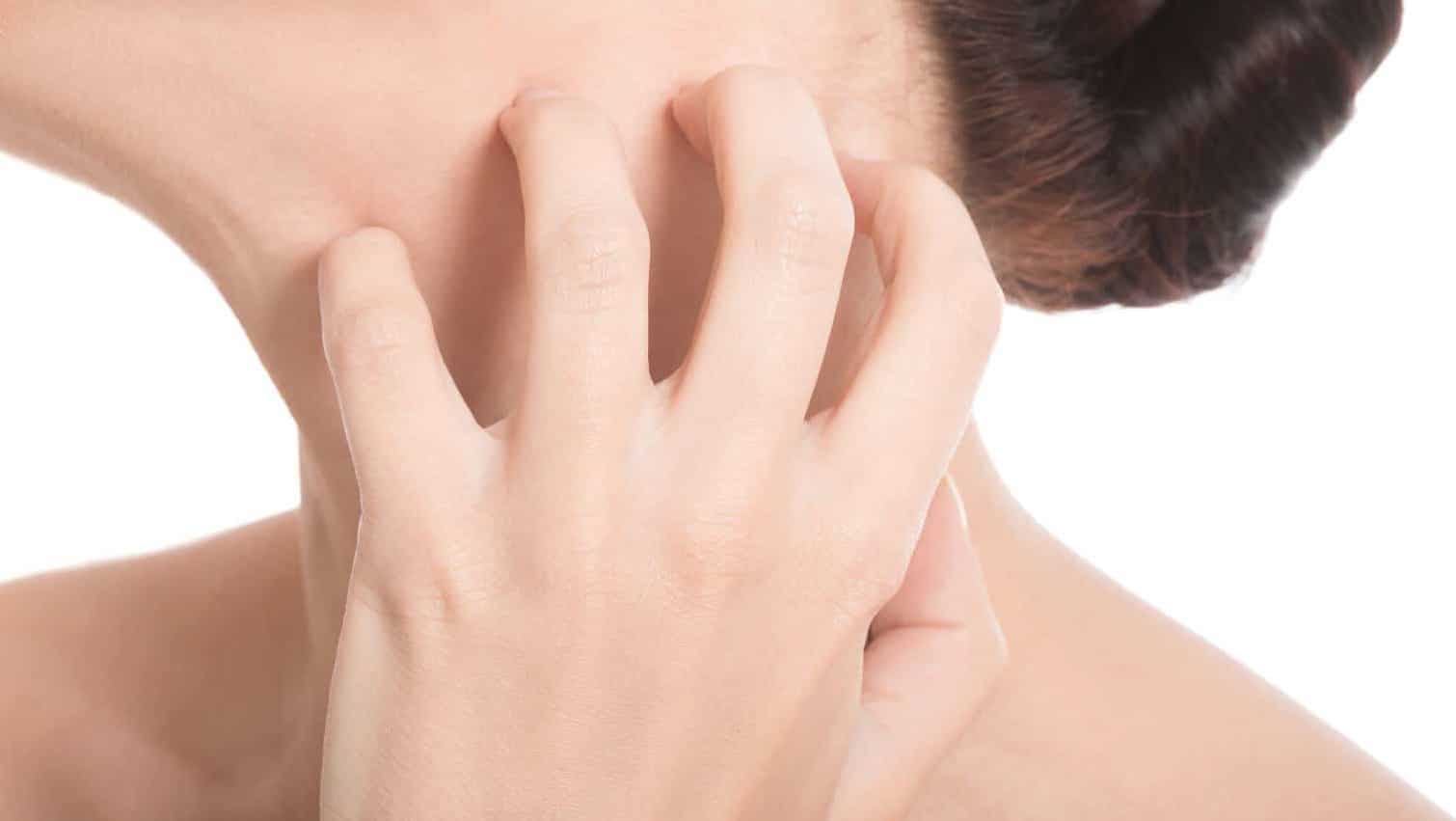 6 Common Summer Skin Rashes Short Hills Dermatology