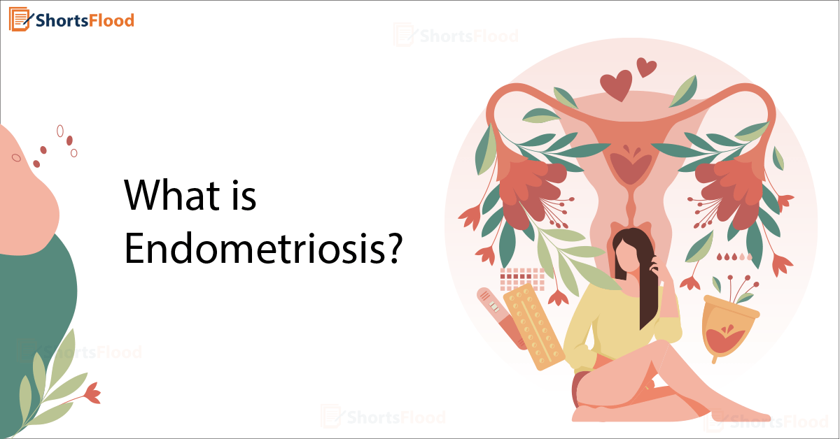 What is Endometriosis? ShortsFlood