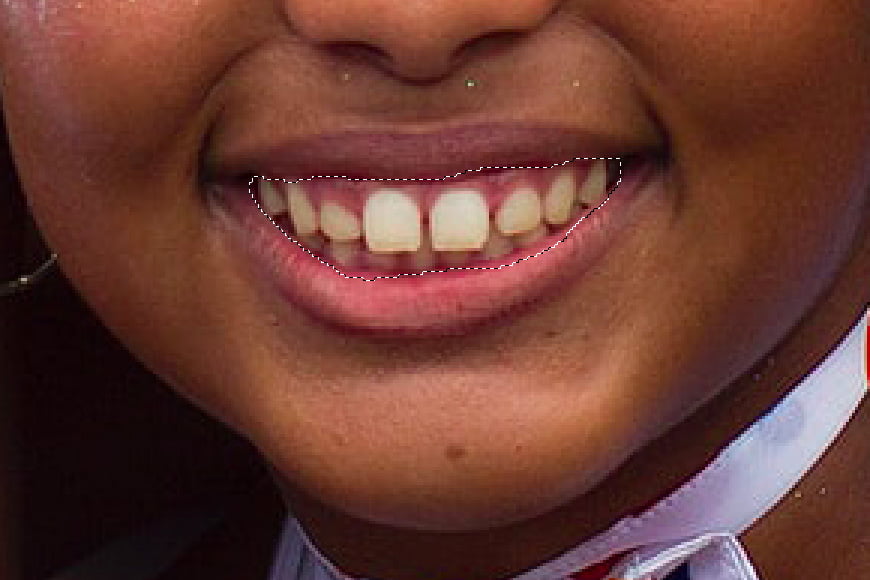 How To Whiten Teeth In 4 Best Methods!