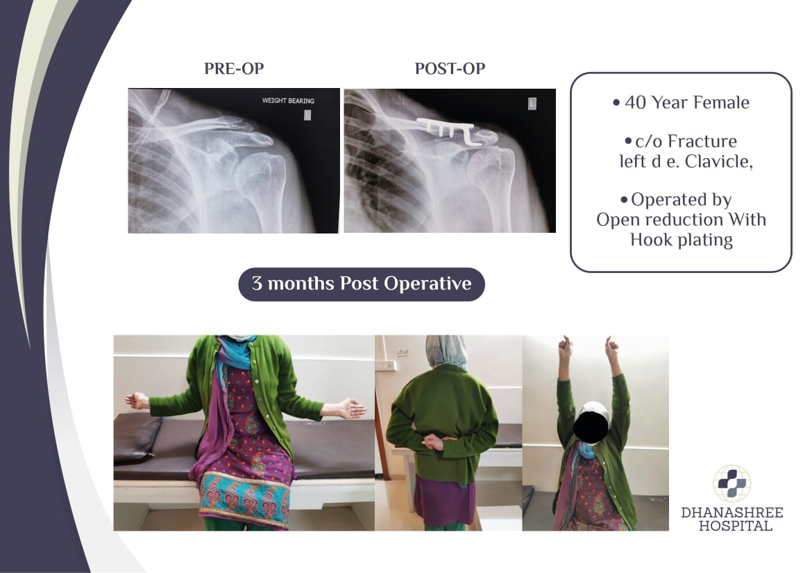 Shoulder Specialist In Pune Shoulder Specialist Doctor Shoulder