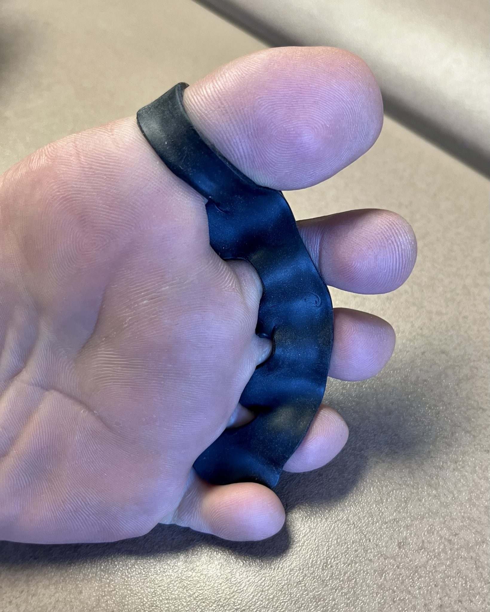 The Toe Spacer Review Do Toe Spacers Work?