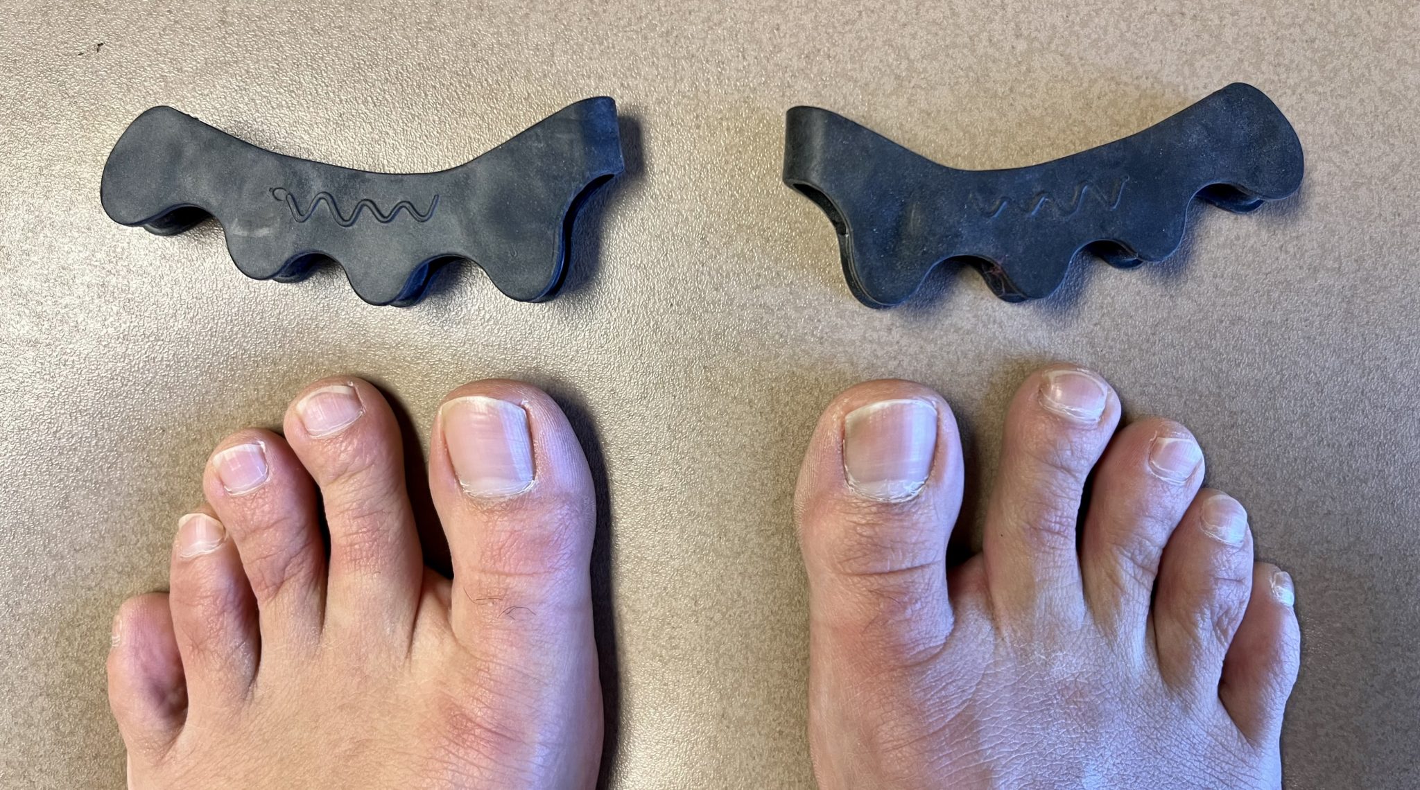 The Toe Spacer Review Do Toe Spacers Work?