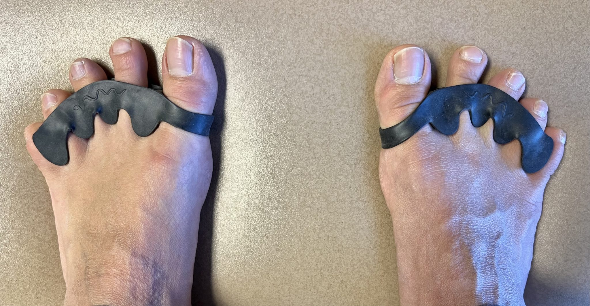 The Toe Spacer Review Do Toe Spacers Work?