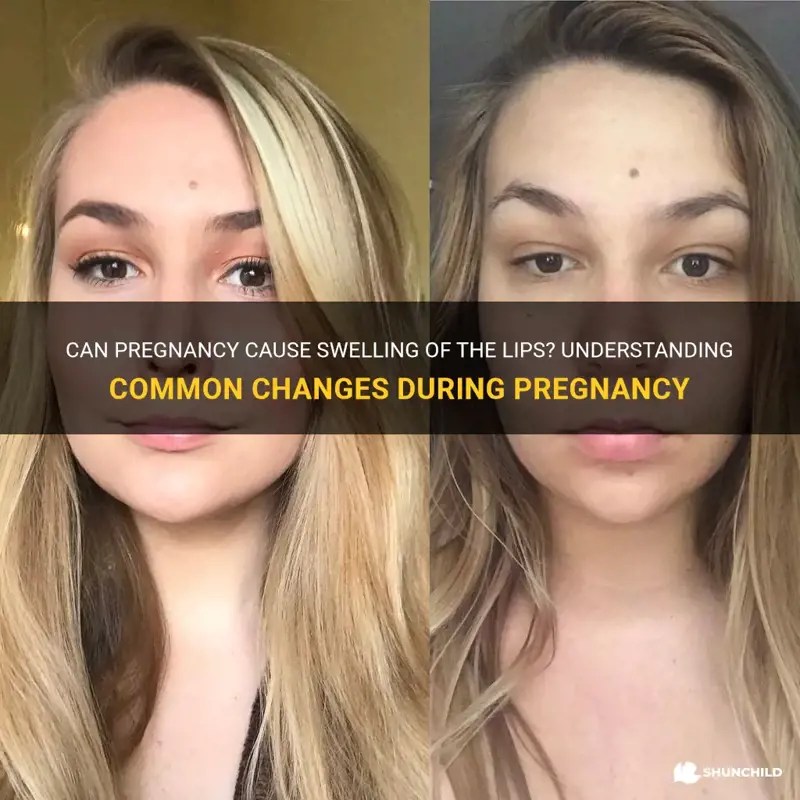 Can Pregnancy Cause Swelling Of The Lips? Understanding Common Changes During Pregnancy ShunChild