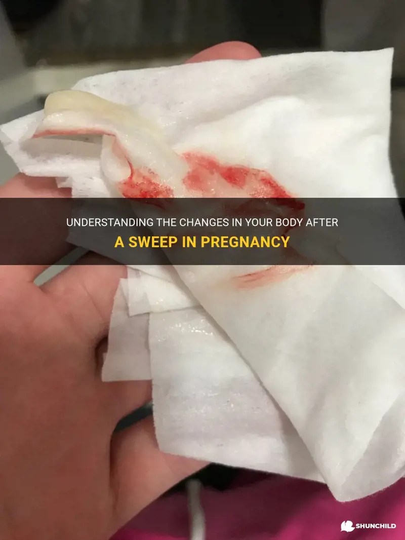 Understanding The Changes In Your Body After A Sweep In Pregnancy