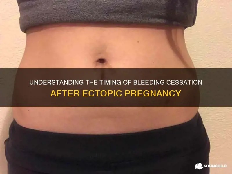 Understanding The Timing Of Bleeding Cessation After Ectopic Pregnancy