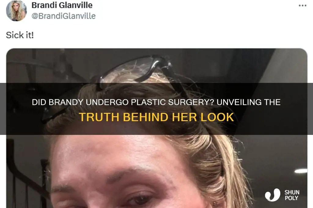 Did Brandy Undergo Plastic Surgery? Unveiling The Truth Behind Her Look