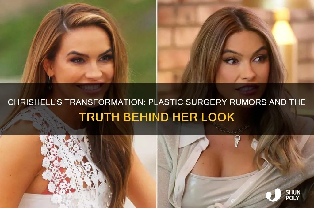 Chrishell's Transformation Plastic Surgery Rumors And The Truth Behind