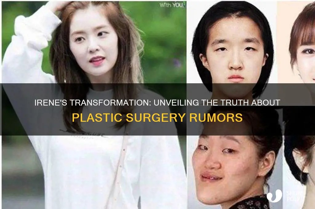 Irene's Transformation Unveiling The Truth About Plastic Surgery