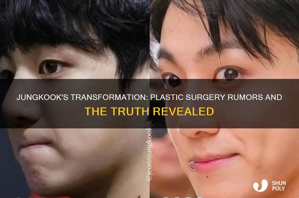 Jungkook's Transformation Plastic Surgery Rumors And The Truth