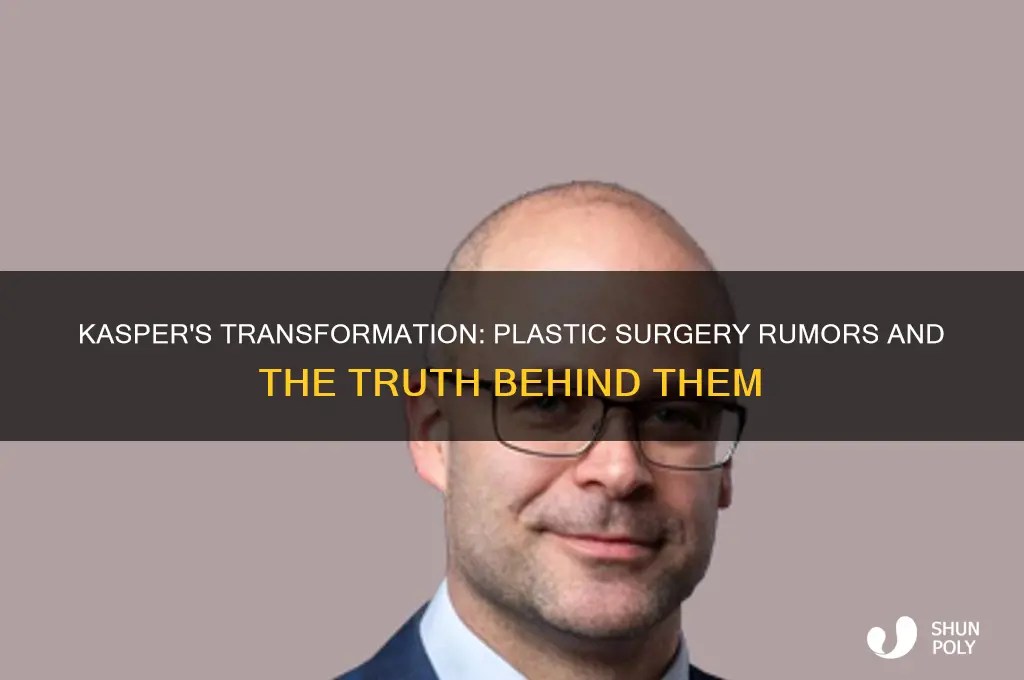 Kasper's Transformation Plastic Surgery Rumors And The Truth Behind
