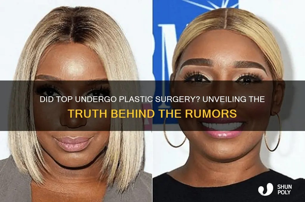 Did Top Undergo Plastic Surgery? Unveiling The Truth Behind The Rumors