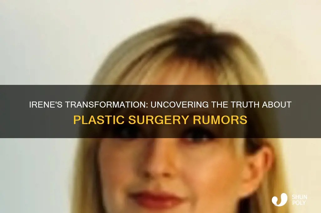 Irene's Transformation Uncovering The Truth About Plastic Surgery