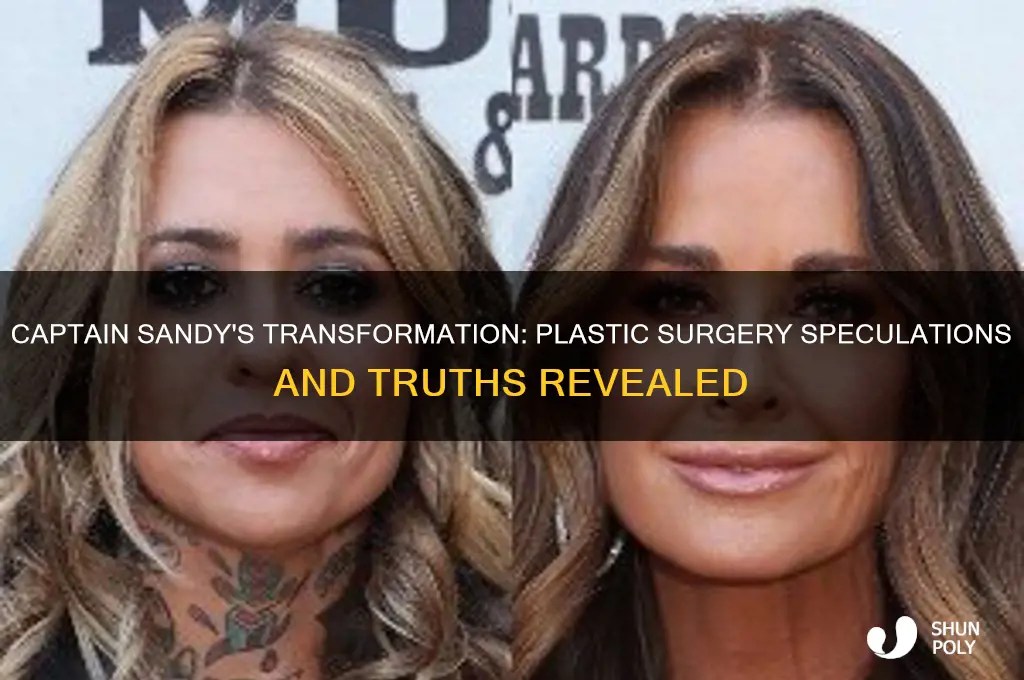 Captain Sandy's Transformation Plastic Surgery Speculations And Truths