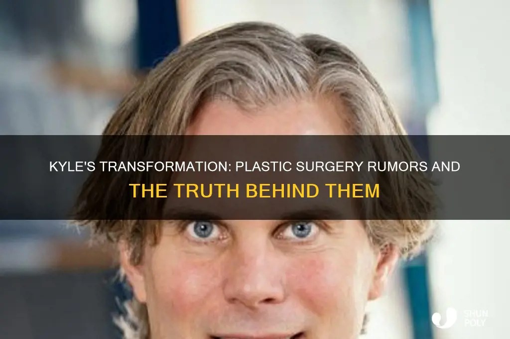 Kyle's Transformation Plastic Surgery Rumors And The Truth Behind Them