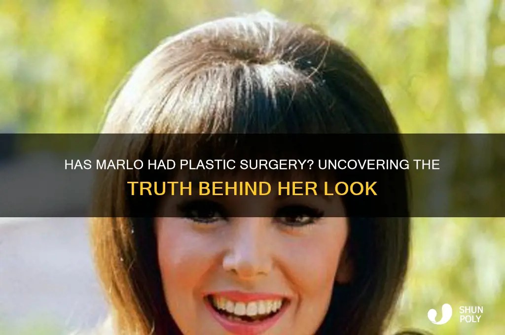 Has Marlo Had Plastic Surgery? Uncovering The Truth Behind Her Look