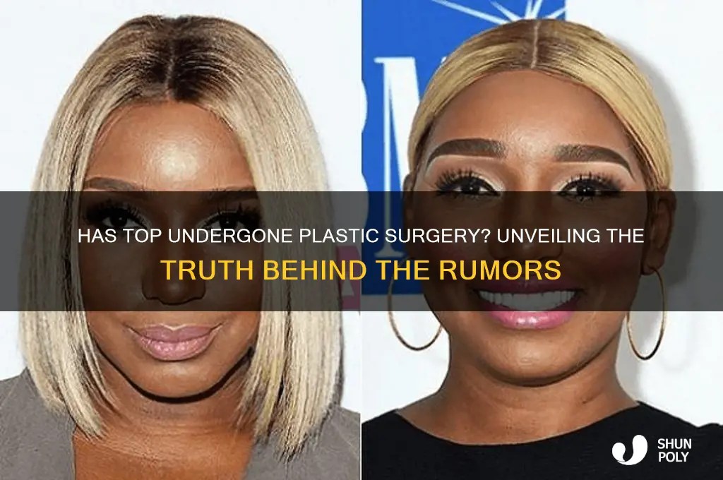 Has Top Undergone Plastic Surgery? Unveiling The Truth Behind The
