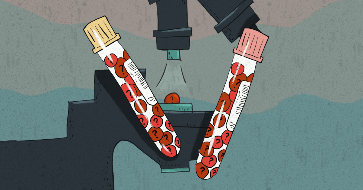 Blood Test for Sickle Cell Disease
