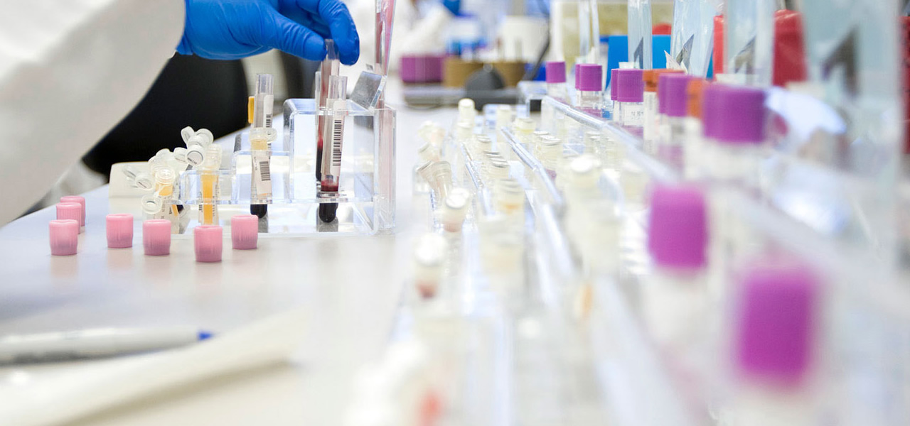 BIOBANKING What is Biobanking and Why is it Important