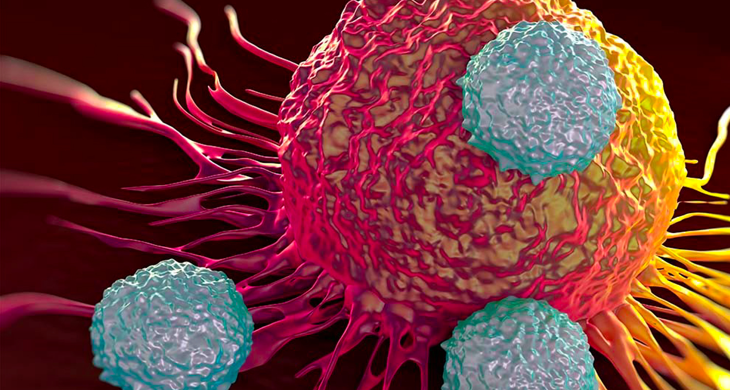 Haciendo visible el cáncer diagnóstico por imágenes en la oncología