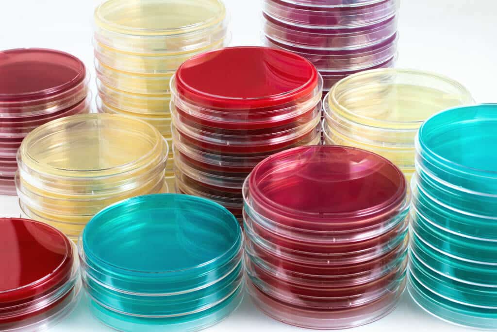 Best Agar recipe and protocols SillyMyco