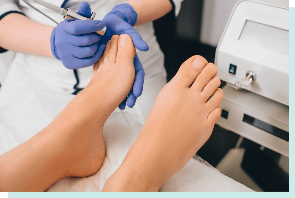 Laser Toenail Fungus Treatment Calgary Silverado Aesthetic Clinic
