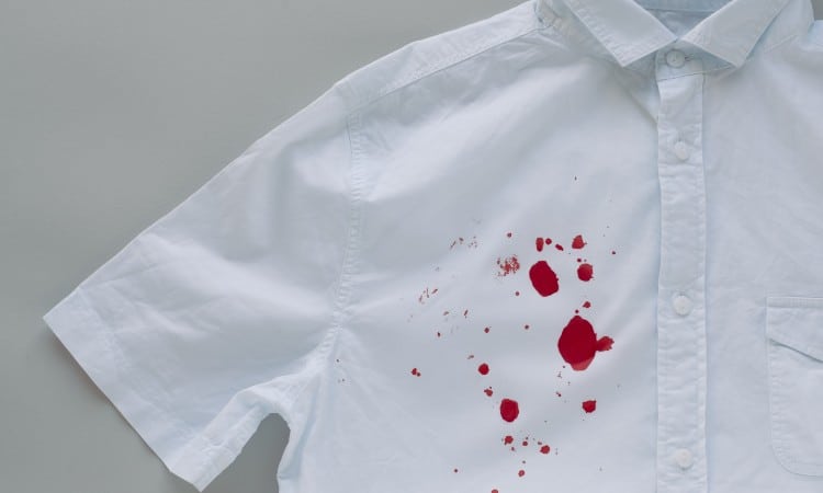 How To Get Stains Out Of Polyester