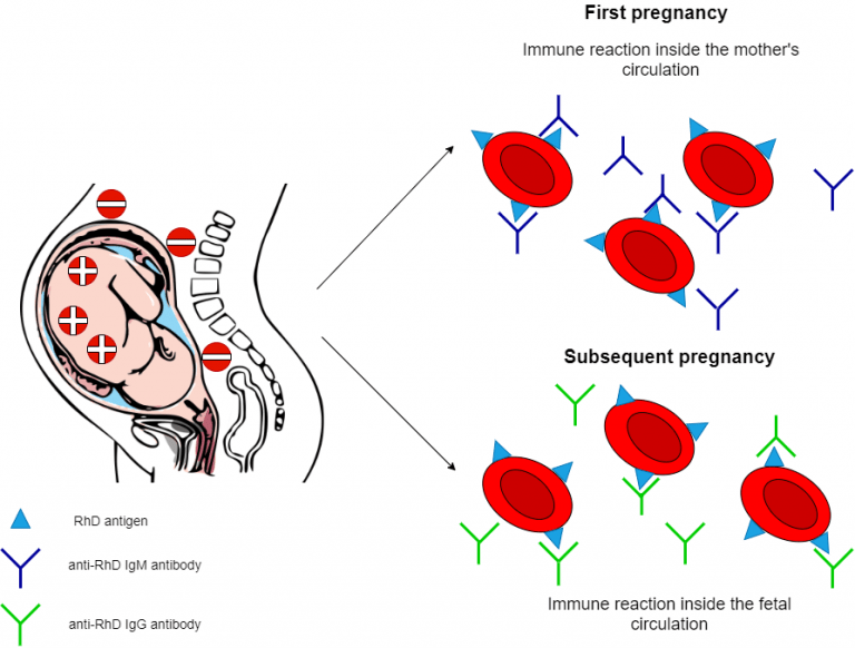 Hemolytic disease of the newborn Simplebiol