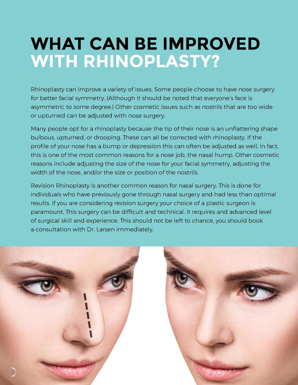 The Essential Guide to Rhinoplasty