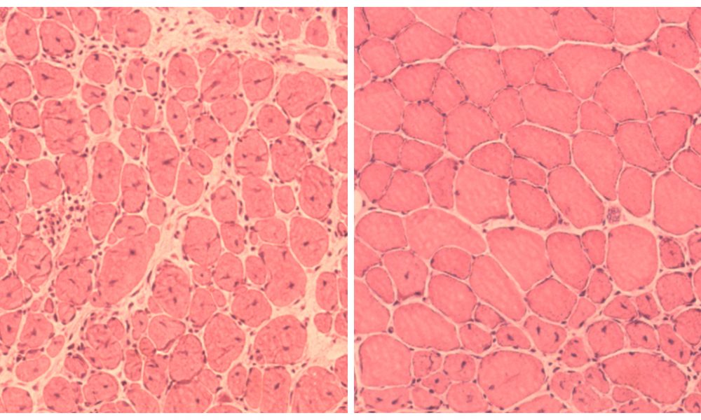 In A Shocking Discovery, Scientists Reverse Ageing Process! "Humans