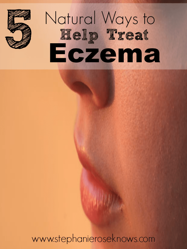 5 Natural Ways to Help Treat Eczema Simple in the Country