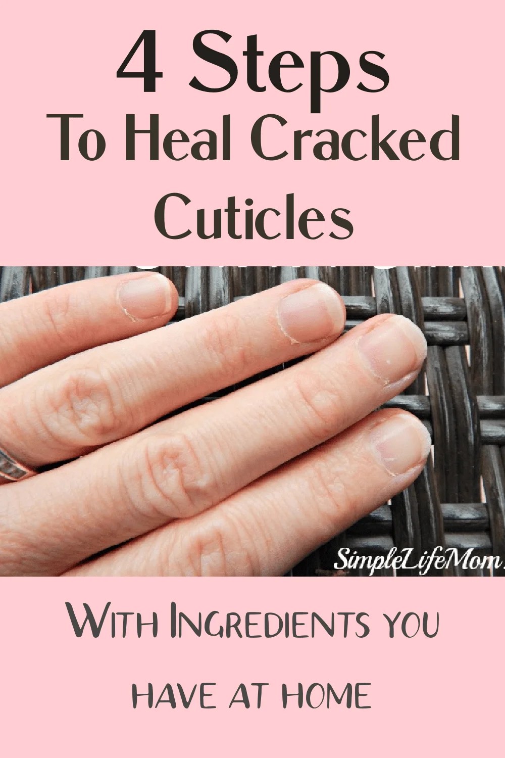 4 Steps to Heal Cracked Cuticles with Natural Ingredients Simple Life Mom