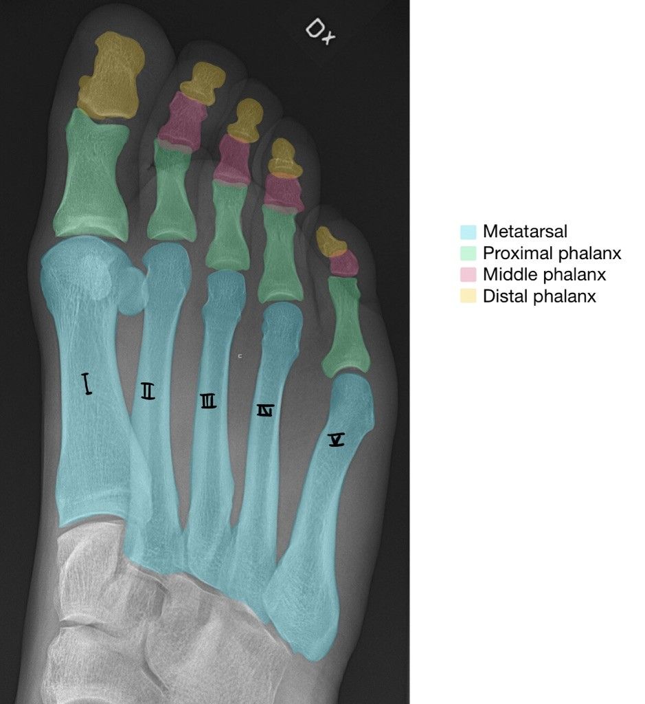 5. Bones of the Foot SimpleMed Learning Medicine, Simplified
