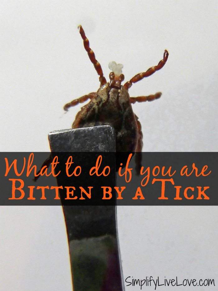 Tick Bite First Aid Best Tips for Prevention and Recovery Simplify