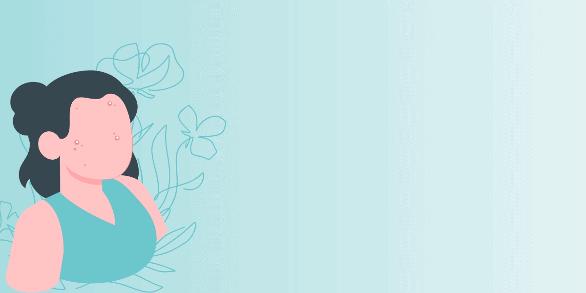 Menopausal Acne Causes, Treatment, and Prevention Strategies