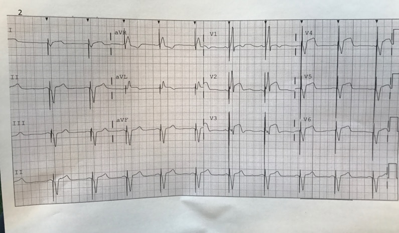 3 Gründe, die den EKG und Schrittmacher Notfallkurs einzigartig machten