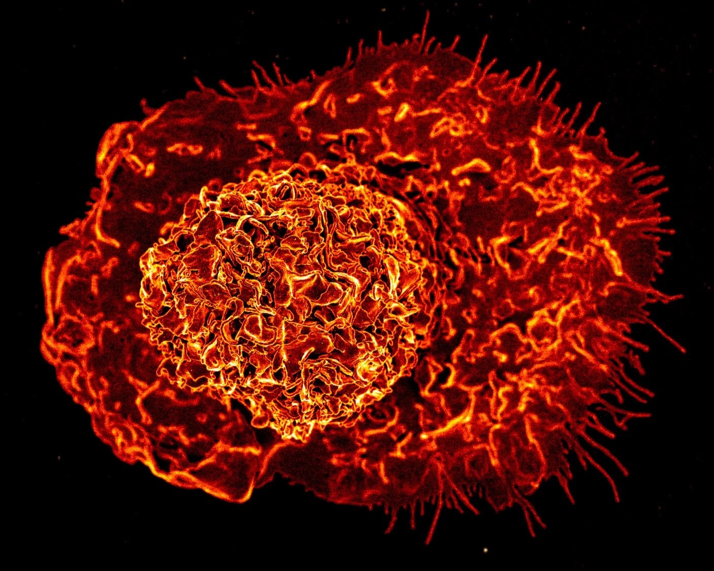 Scientists Say a Newly Discovered Immune Cell May Drive Inflammation as We Age Scientists Say a Newly Discovered Immune Cell May Drive Inflammation as We Age